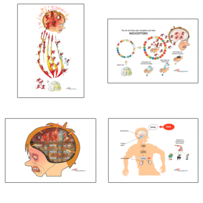 Fisiología del dolor – Cuatro imágenes – descarga digital